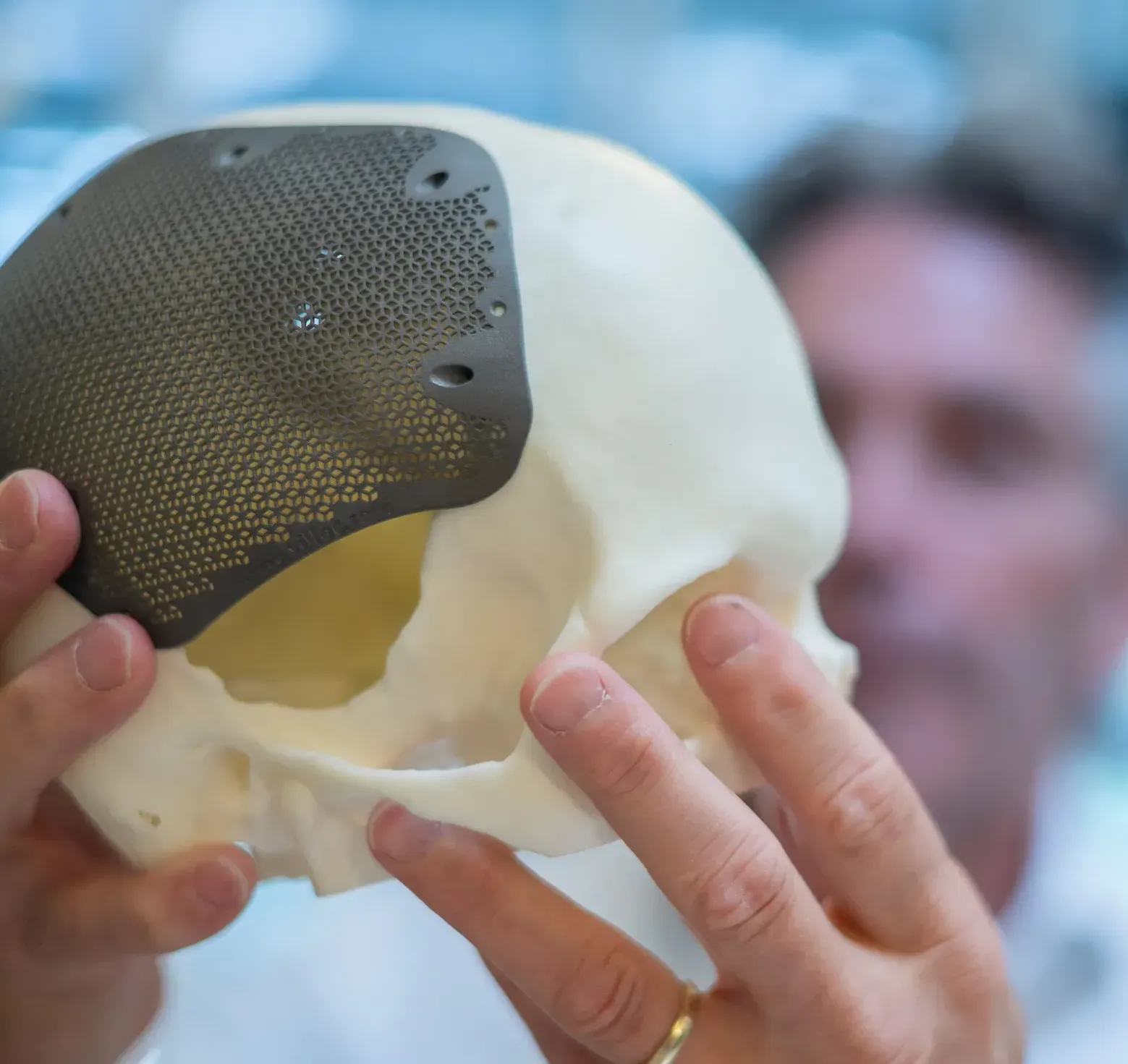 cranial implant titanium