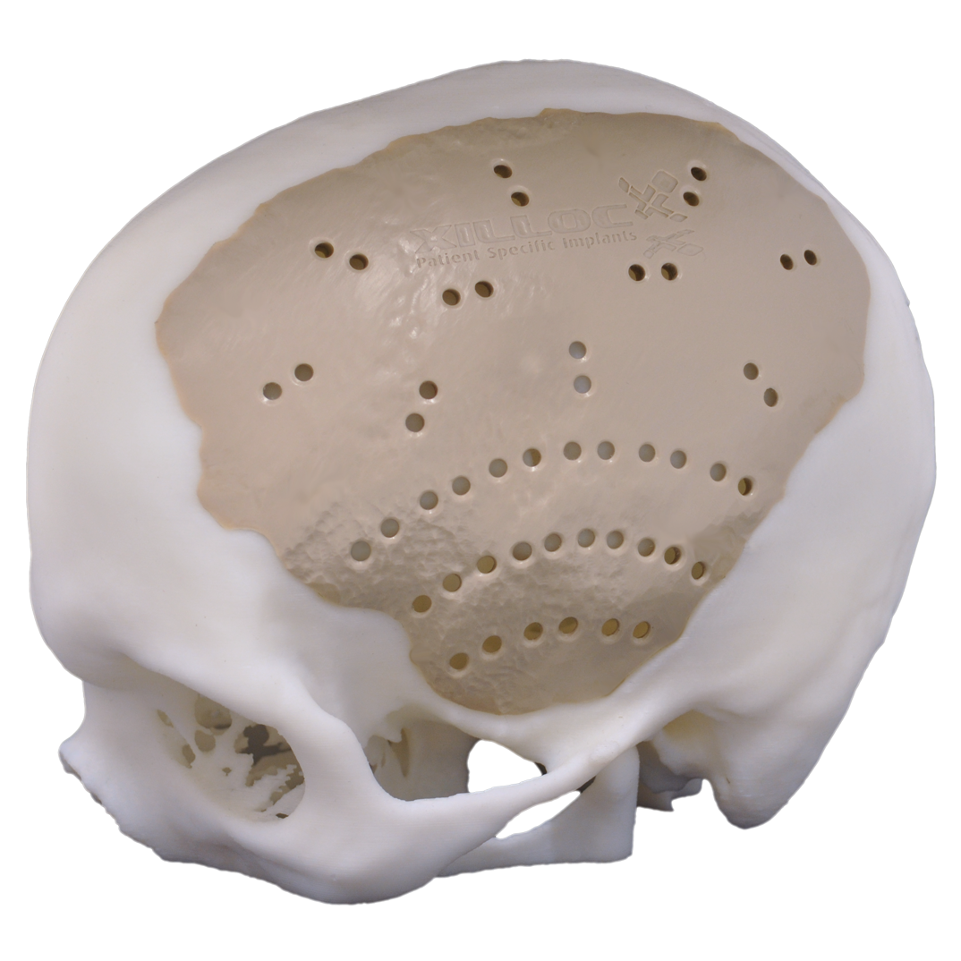 How to create a negative mold for a complex model? blenderhelp