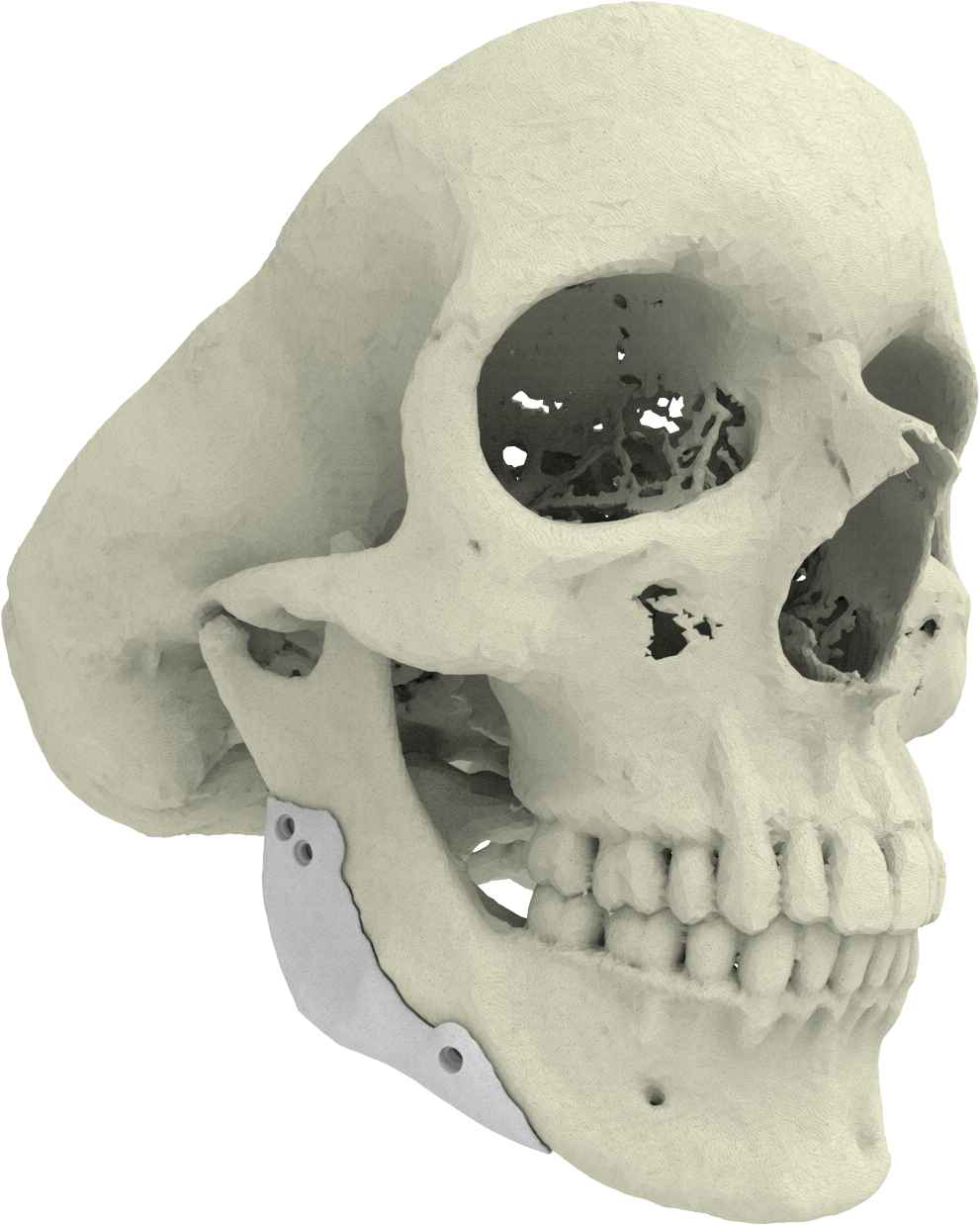 CT-Bone | 3D printing real bone | Xilloc