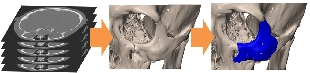 ct-bone flow